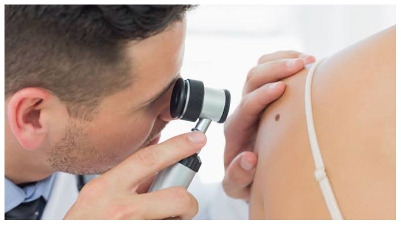 Skin Check
